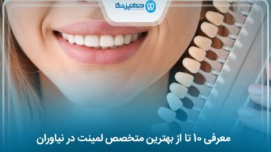 بهترین متخصص لمینت در نیاوران