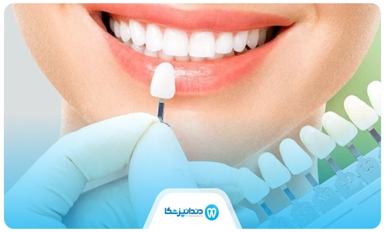 مشکلات و معضلات بهترین دکتر لمینت در نیاوران