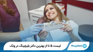 بهترین دکتر بلیچینگ در ونک