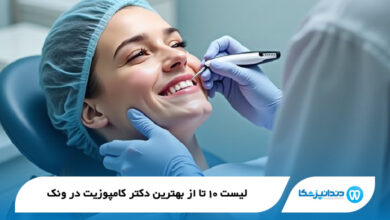 بهترین دکتر کامپوزیت در ونک