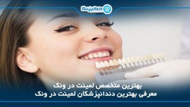 بهترین متخصص لمینت در ونک