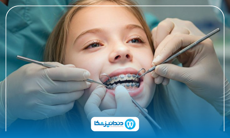 بهترین دکتر ارتودنسی در ونک