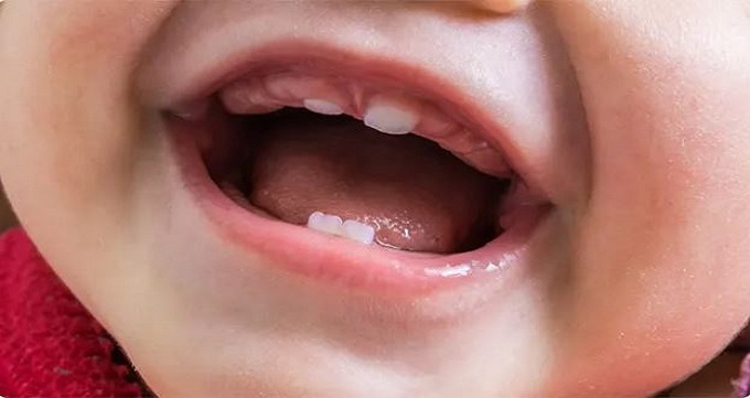چه زمانی باید به دندانپزشک کودکان مراجعه کرد؟