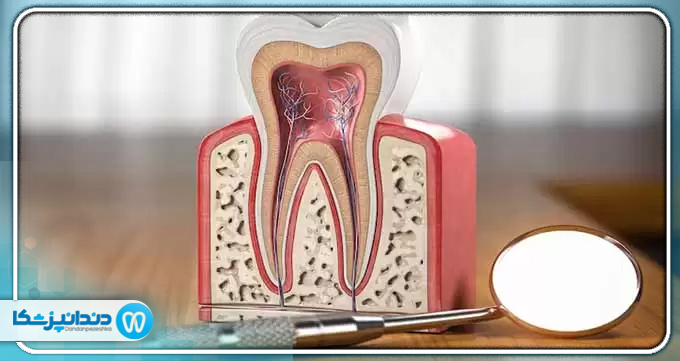 بهترین دندانپزشک درمان ریشه در ونک