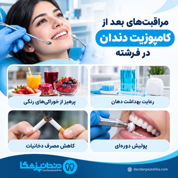 مراقبت های بعد از کامپوزیت دندان در فرشته
