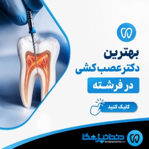 بهترین دکتر عصب کشی در فرشته