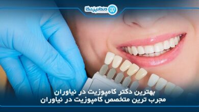 بهترین دکتر کامپوزیت در نیاوران