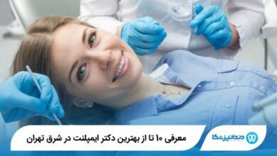 بهترین دکتر ایمپلنت در شرق تهران