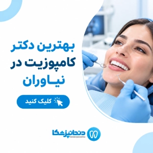 بهترین دکتر کامپوزیت در نیاوران
