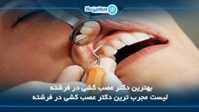 بهترین دکتر عصب کشی در فرشته