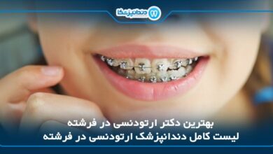 بهترین دکتر ارتودنسی در فرشته