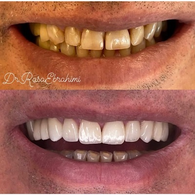 دکتر رسا ابراهیمی سرخابی