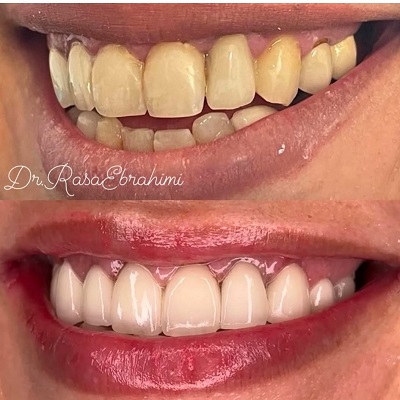 دکتر رسا ابراهیمی سرخابی