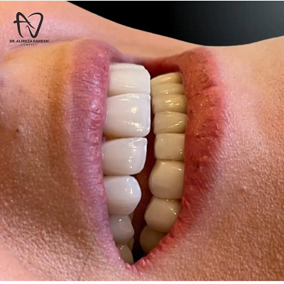 دکتر علیرضا دهش