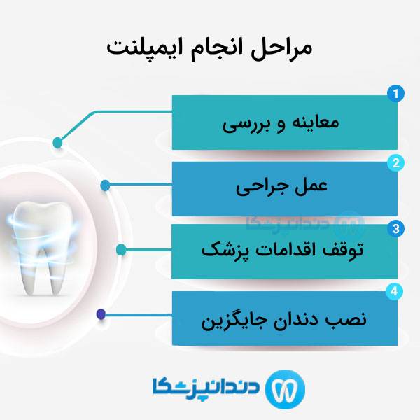مواد سازنده ایمپلنت دندان چیست؟