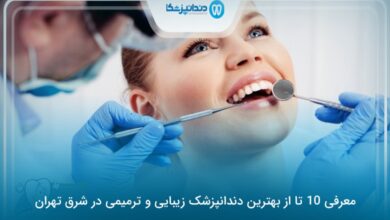 دندانپزشک زیبایی و ترمیمی در شرق تهران