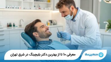 بهترین دکتر بلیچینگ در شرق تهران