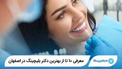 بهترین دکتر بلیچینگ در اصفهان