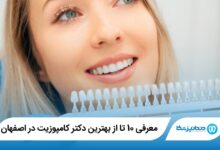 بهترین دکتر کامپوزیت در اصفهان