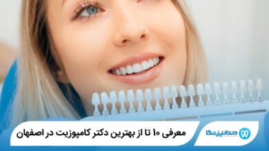 بهترین دکتر کامپوزیت در اصفهان