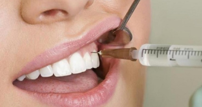 علت آسیب رساندن دندان عقل به دندان های دیگر