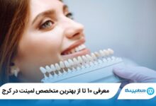 بهترین متخصص لمینت در کرج