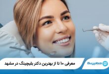 بهترین دکتر بلیچینگ در مشهد