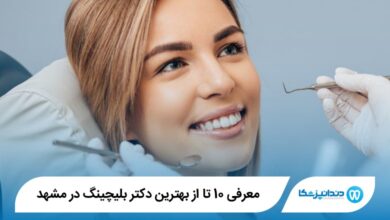 بهترین دکتر بلیچینگ در مشهد