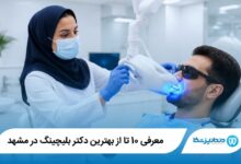 بهترین دکتر بلیچینگ در مشهد