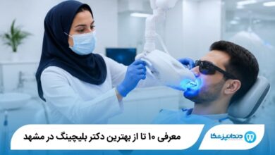بهترین دکتر بلیچینگ در مشهد