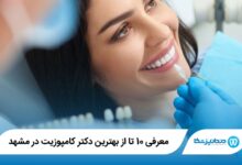 بهترین دکتر کامپوزیت در مشهد