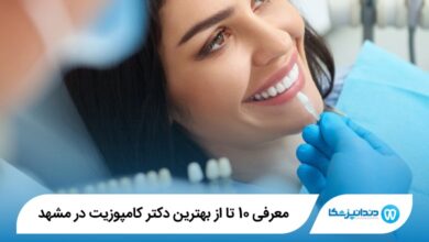 بهترین دکتر کامپوزیت در مشهد
