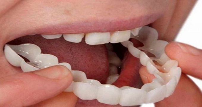 مزایا و معایب انجام کامپوزیت دندان