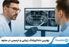 بهترین دندانپزشک زیبایی و ترمیمی در مشهد