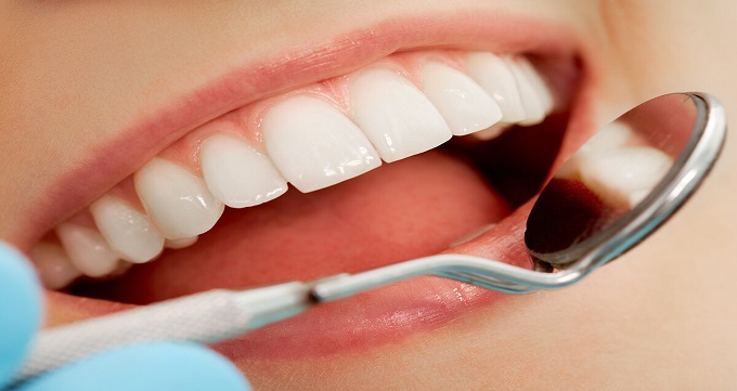 توصیه هایی جهت انجام دندانپزشکی زیبایی و ترمیمی