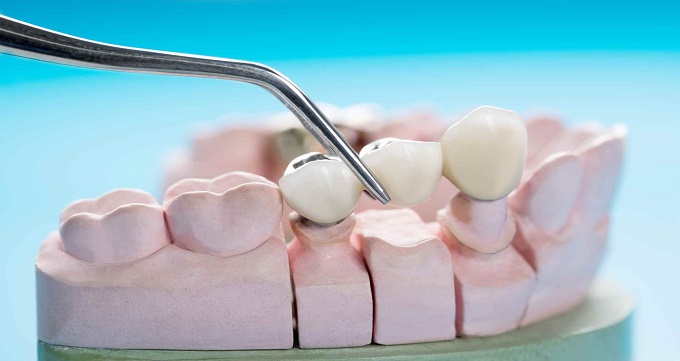 ویژگی های بهترین دکتر پروتز دندان در مشهد