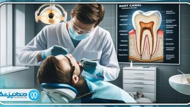 بهترین دندانپزشک درمان ریشه در شیراز