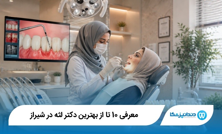 بهترین دکتر لثه در شیراز