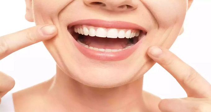 توصیه های قبل و بعد از انجام لمینت دندان