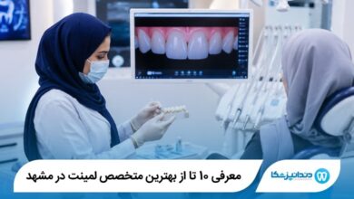 بهترین متخصص لمینت در مشهد