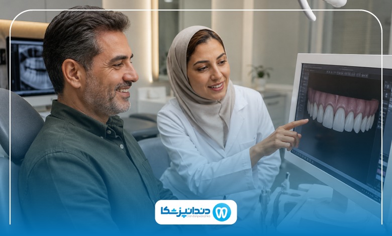 مقایسه لمینت سرامیکی و کامپوزیتی