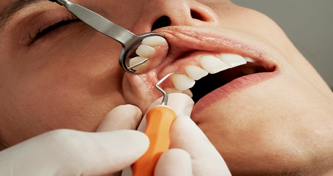علل پوسیدگی دندان و درد آن چیست؟