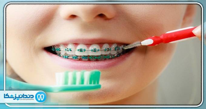بهترین دندانپزشک کودکان در سعادت آباد