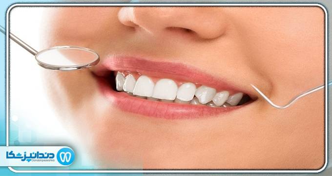 بهترین دندانپزشک درمان ریشه در مشهد