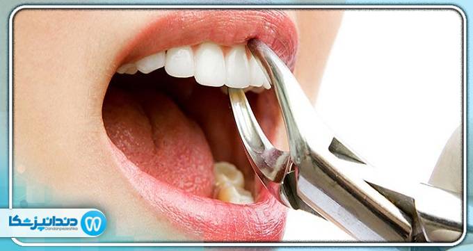 بهترین دندانپزشک درمان ریشه در سعادت آباد