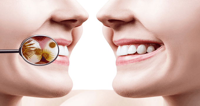تفاوت عصب کشی دندان و درمان ریشه