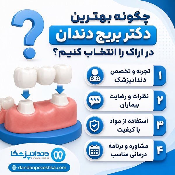راهنمای انتخاب بهترین دکتر بریج دندان در اراک