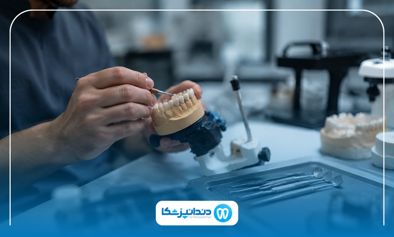 بریج دندان در همدان چگونه انجام میشود؟