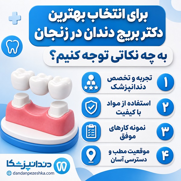 چگونه بهترین دکتر بریج دندان در زنجان را انتخاب کنیم؟