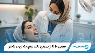 معرفی 10 تا از بهترین دکتر بریج دندان در زنجان